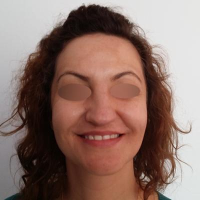 1 Inainte De Interventie