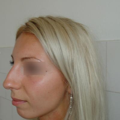 1 Inainte De Inteventie