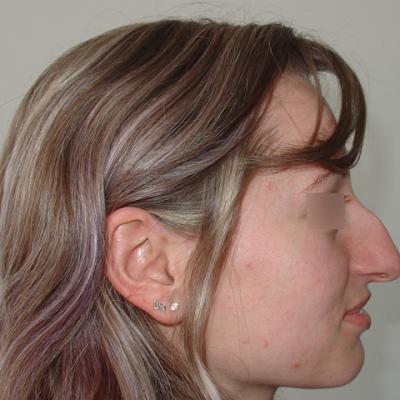 2 Inainte De Interventie2