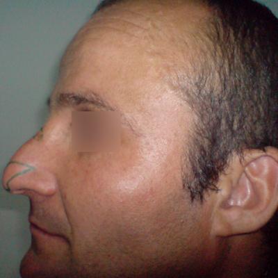 2 Inainte De Interventie